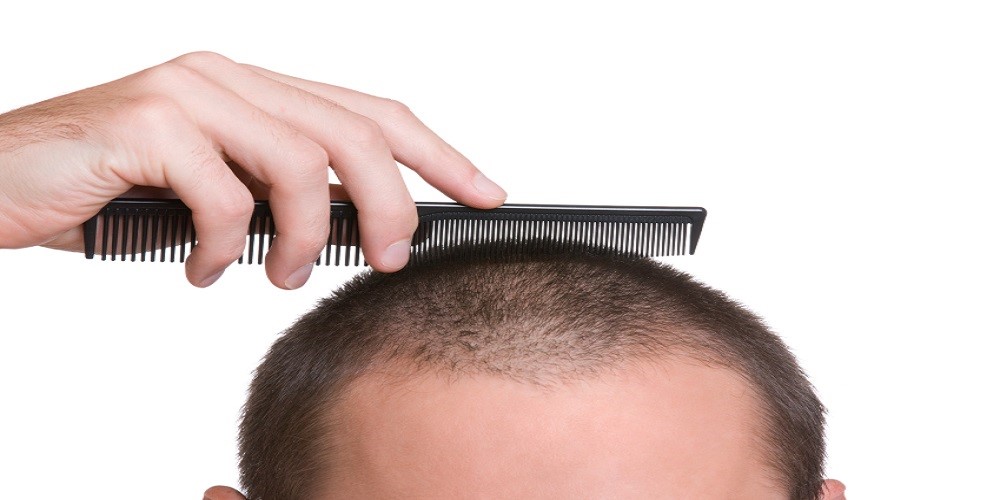 Hair treatment